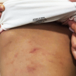 Cô giáo bị tố bạo hành bé gái 2 tuổi